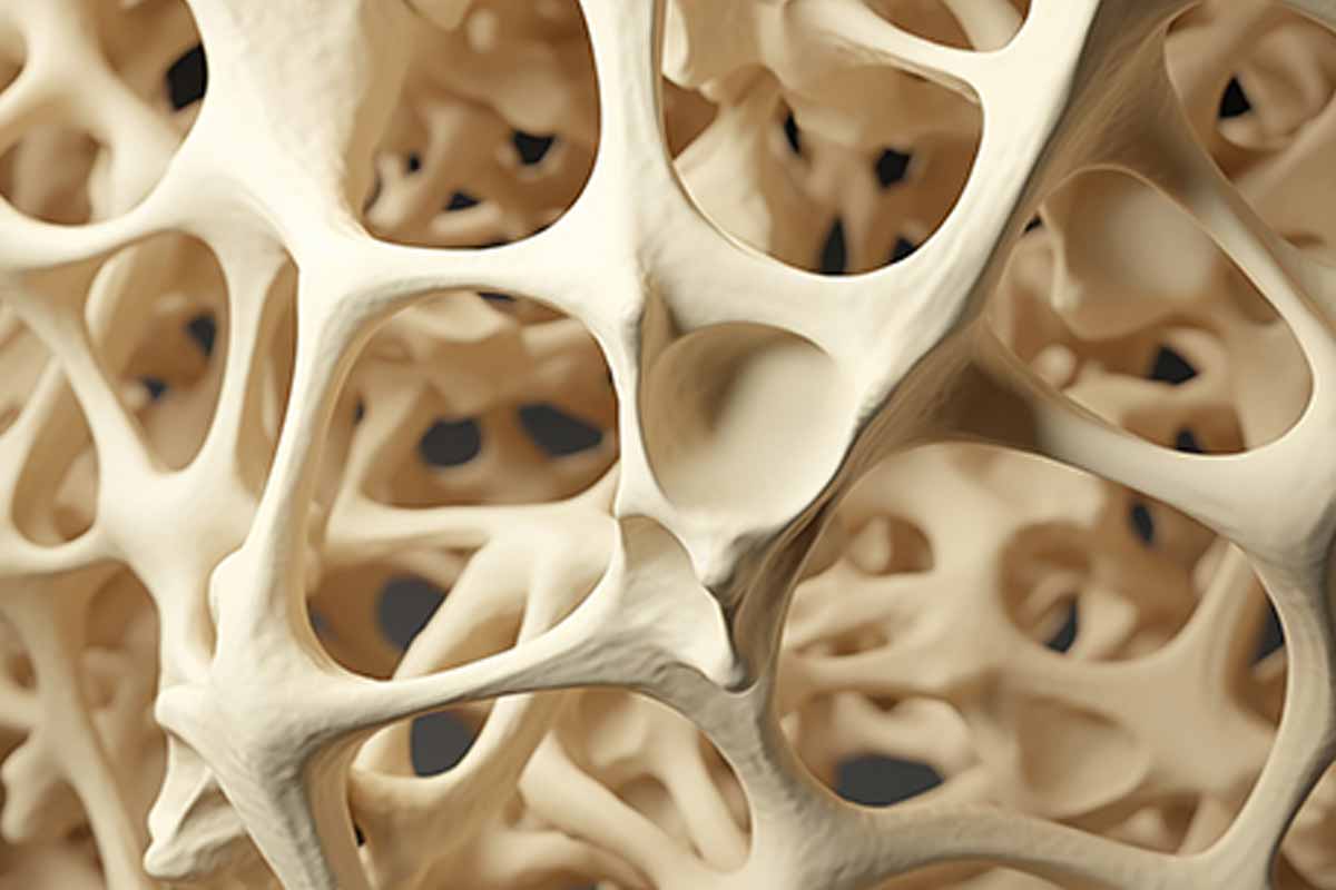 osteoporosis